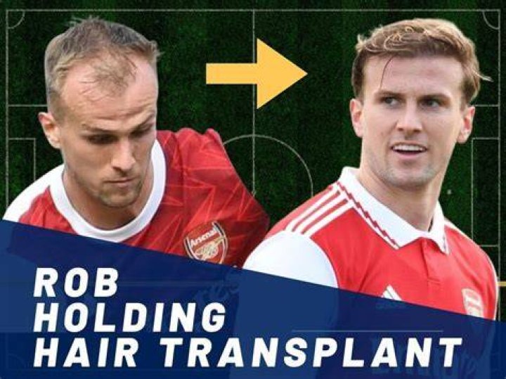 
Does Rob Holding Have New Hair? Fans Notice Something Different About The Arsenal Player 